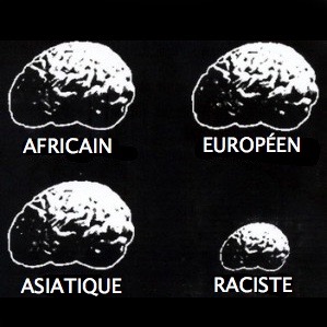raciste-du-cerveau-1